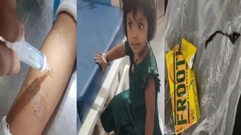 CG News : 10 रुपए की फ्रूटी में निकली छिपकली, पीते ही मासूम बच्ची की तबीयत बिगड़ी, इलाके में हड़कंप
