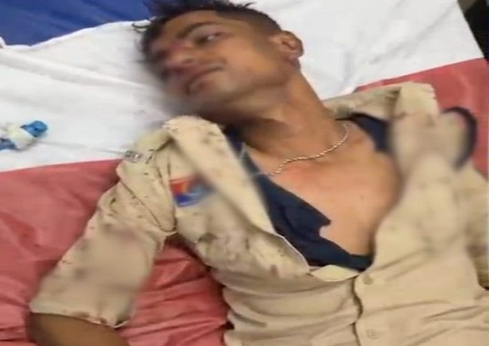 CG News: डायल-112 के आरक्षक पर हमला, नशे में धुत युवक ने डंडे से किया वार, जवान घायल