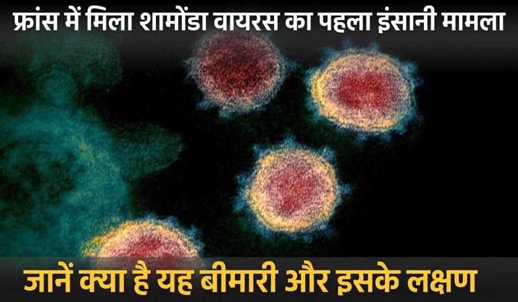 Shamonda Virus: फ्रांस में मिला ‘शामोंडा वायरस’ का पहला इंसानी मामला, जानें क्या है यह बीमारी और इसके लक्षण
